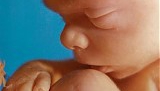 UNICEF i WHO manipulują katolikami latynoamerykańskimi w sprawie aborcji