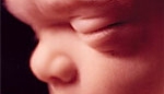 USA: skarga na uczelnię za zmuszanie do asystowania przy aborcji 