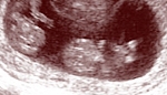 USA: Teksas wprowadza ustawę ograniczającą aborcję