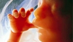 W. Brytania: wzrosła liczba aborcji niepełnosprawnych dzieci