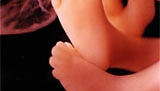 Aborcjonista musi zapłacić wysokie odszkodowanie dziecku, któremu udało się przeżyć